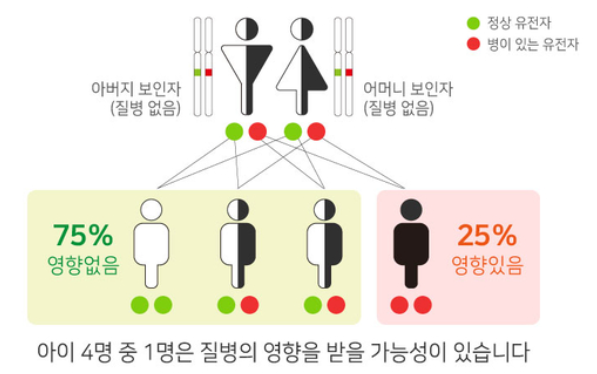 난청 유전자는 무엇이 있으며 청력저하가 있으면 무조건해야 하나?