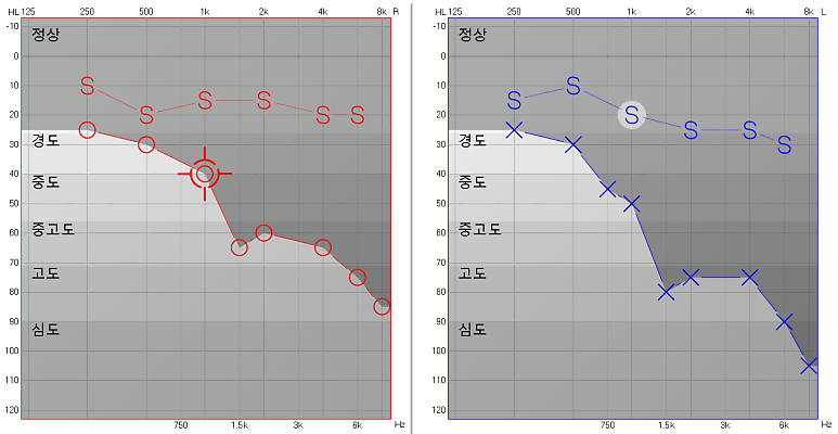 포낙 비르토 인피니오R 90(비르토 I-R 90)을 선택한 이유? 작업·통화·충전까지 모두 고려했습니다