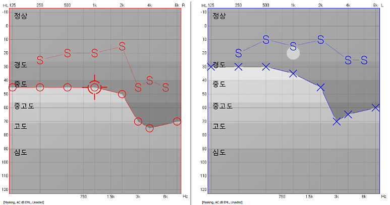포낙 오데오인피니오스피어 60대 사업가 착용 후기