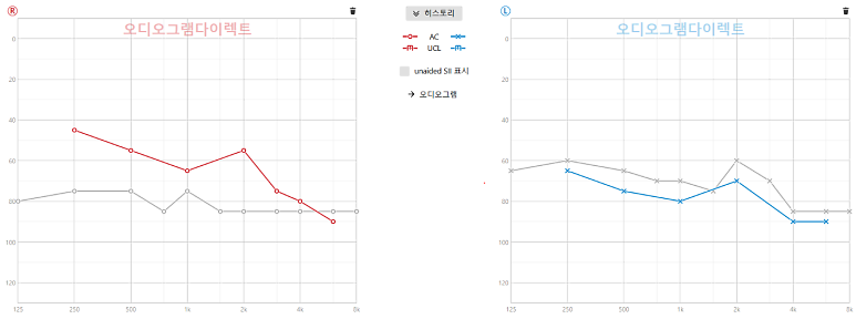 정확한 청력검사를 위한 기본, 검사장비 보정이 왜 중요할까?
