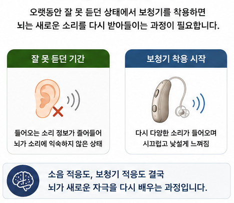 소음도 적응이 필요할까? 정신건강의학과 교수 칼럼으로 보는 감각 적응 이야기