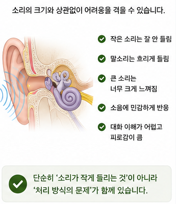 보청기 소리 압축이란? 왜 작게 말하면 못 듣고 크게 말하면 크다고 할까요?