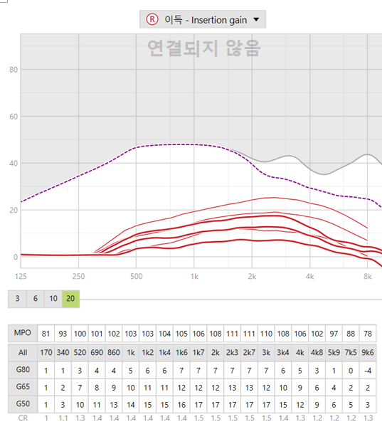 보청기 채널과 밴드란? 왜 높은 등급일수록 더 세밀하게 맞출 수 있을까요?