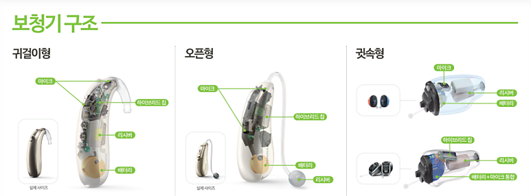 포낙보청기 수리가격 알아보기, 배터리·마이크·스피커 비용은 어떻게 될까?