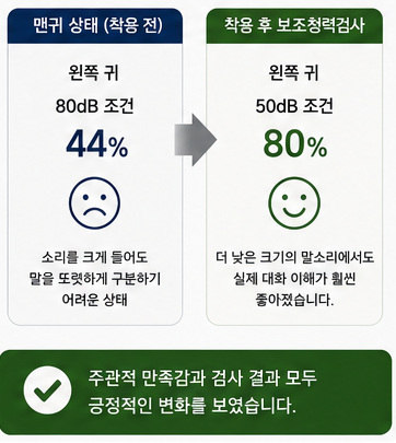 포낙 오데오 인피니오 스피어 대학병원에서 구매하신 60대 여성 고객님 착용 후기