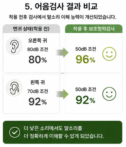 포낙 오데오 인피니오 R 후기, 처음 보청기도 편안하게 적응한 70대 어머님 사례