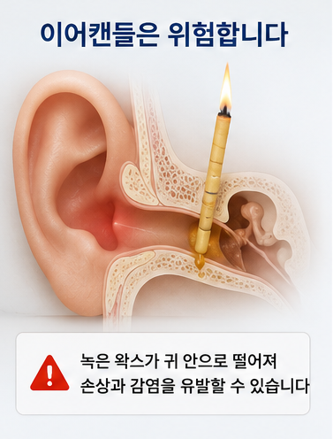 귀에 절대 넣으면 안 되는 것 4가지