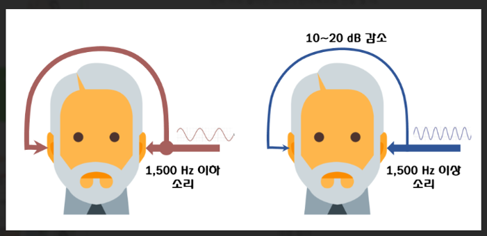 한쪽 귀만 안 들려도 보청기가 필요할까요? 편측성난청 크로스 보청기는 무엇일까요?