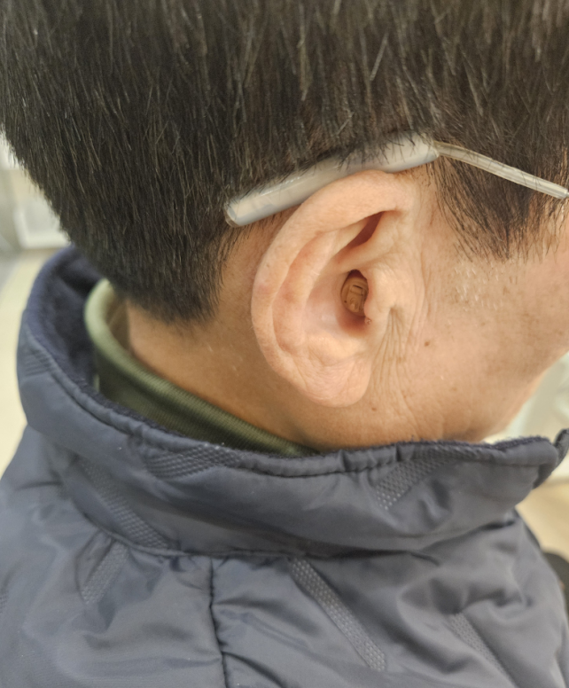 노인성난청, 보청기로 좋아질 수 있을까요?