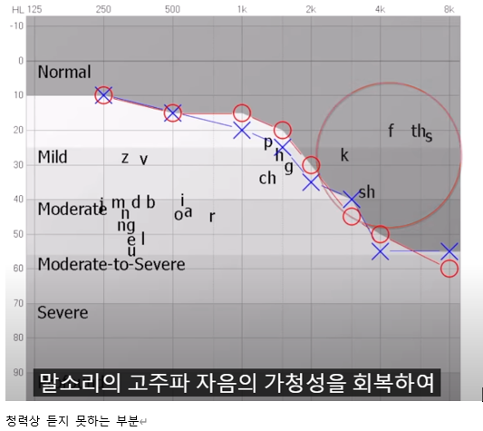 노인성난청, 보청기로 좋아질 수 있을까요?