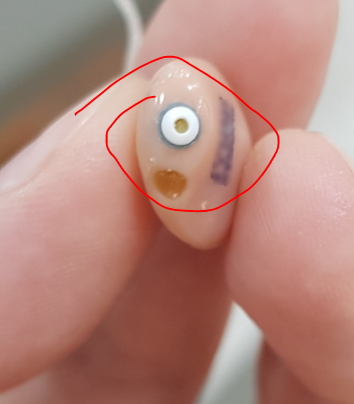 포낙 이지가드, 보청기 귀지 막힘이 잦은 분들에게 도움이 될까요?