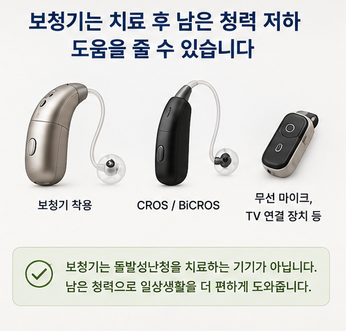 돌발성난청, 귀가 갑자기 먹먹해졌다면 왜 바로 확인해야 할까요?