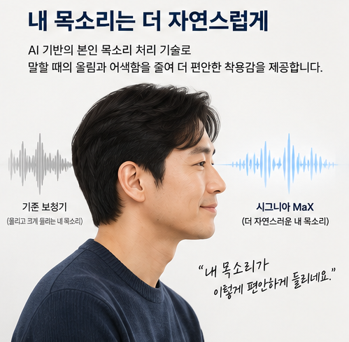 독일 시그니아 보청기 맥스 MaX 출시가 기대되는 4DNN 인공지능 보청기