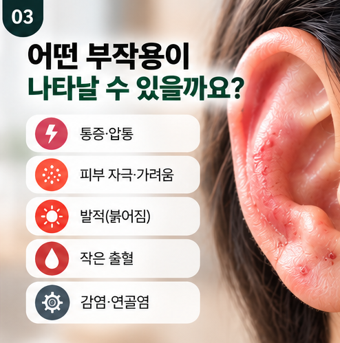 귀혈자리 누른다고 귀침,귀지압 괜찮을까? 귀 건강에도 좋을까?