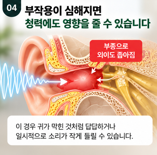 귀혈자리 누른다고 귀침,귀지압 괜찮을까? 귀 건강에도 좋을까?