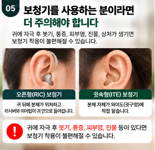 귀혈자리 누른다고 귀침,귀지압 괜찮을까? 귀 건강에도 좋을까?