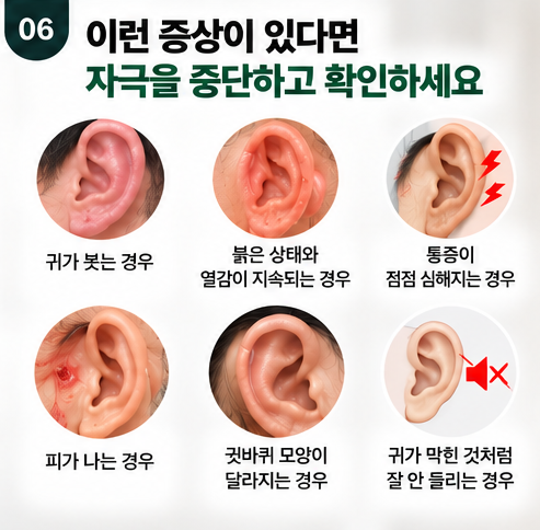 귀혈자리 누른다고 귀침,귀지압 괜찮을까? 귀 건강에도 좋을까?