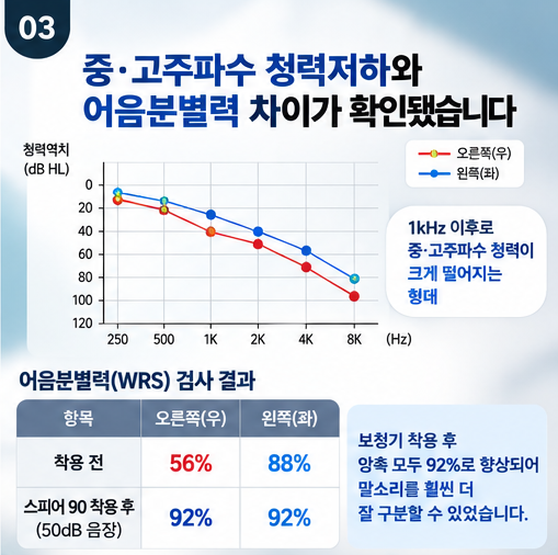 에어팟 보청기 사용 후 포낙 인피니오 스피어로 바꾼 70대 고객 후기