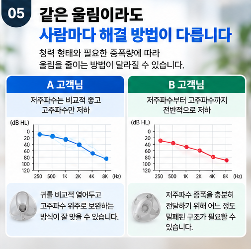 보청기 착용 시 내 목소리가 울리는 이유는? 울리면 무조건 나쁠까? 전문가 필요한 이유!